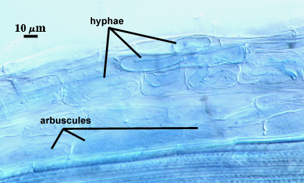 Arbuscules and intraradical hyphae in blue acidic stain