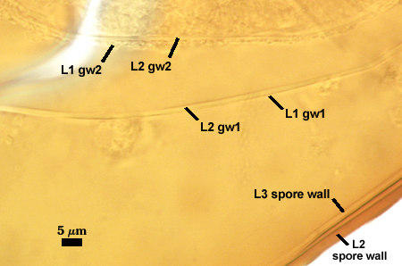 Capsicula spore showing multiple layers at 5µm