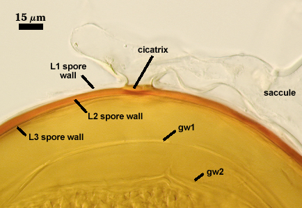 Circular ovoid scar with raised edges