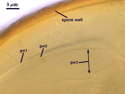 PVLG spore wall Gw1 and Gw2 separated from spore wall adherent to each other