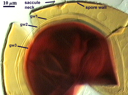 Saccule neck spore wall Gw1 Gw2 and Gw3 note center of spore is dark red