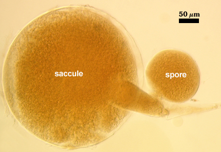 Colossica immature spore and saccule
